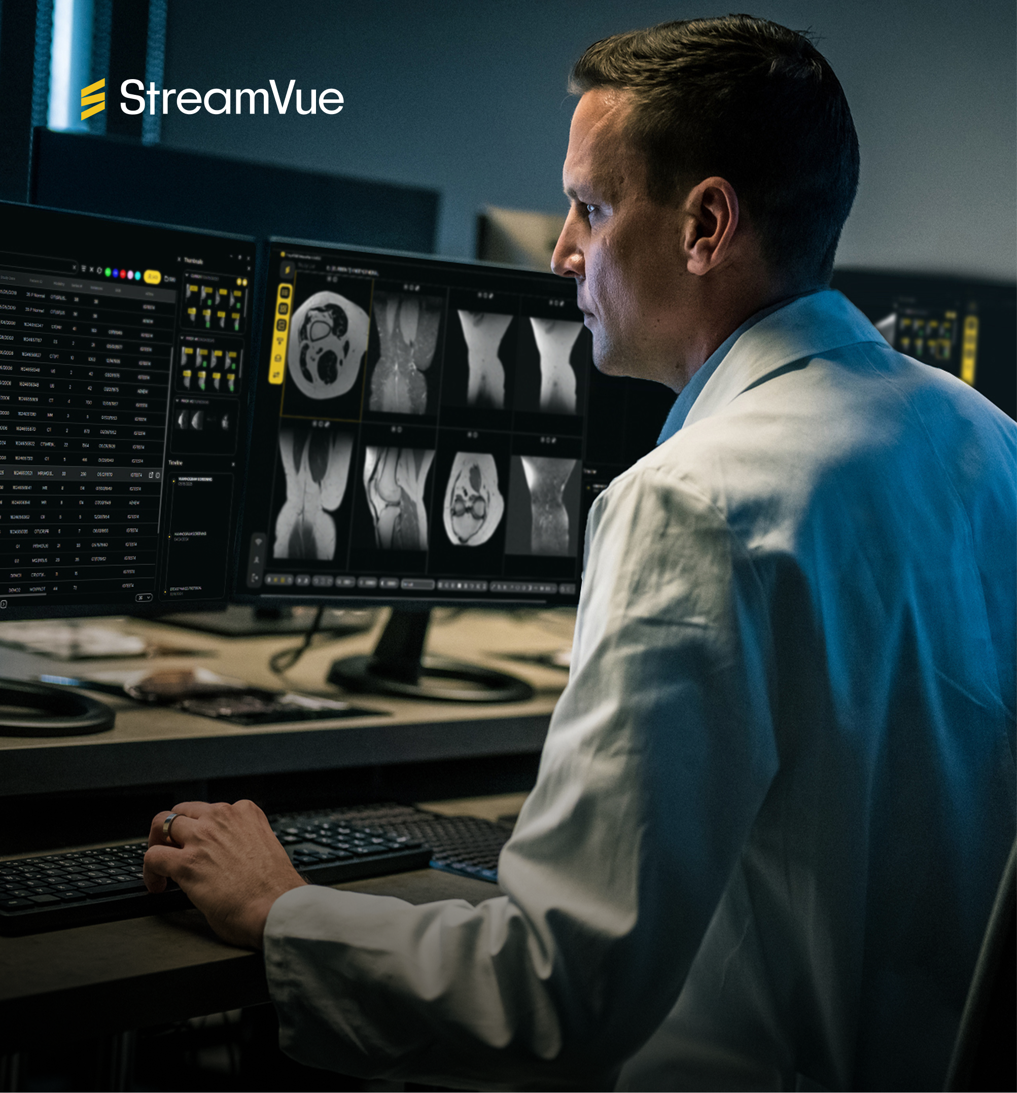 Radiologist reading studies in StreamVue on a diagnostic workstation