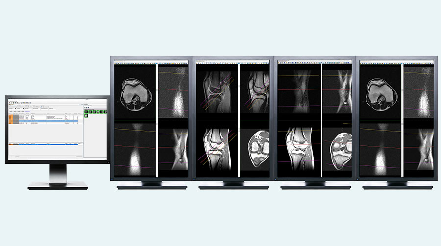 ImageView™ Viewers Candelis