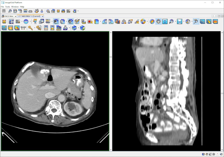 ImageView™ Advanced Radiology Viewer Candelis