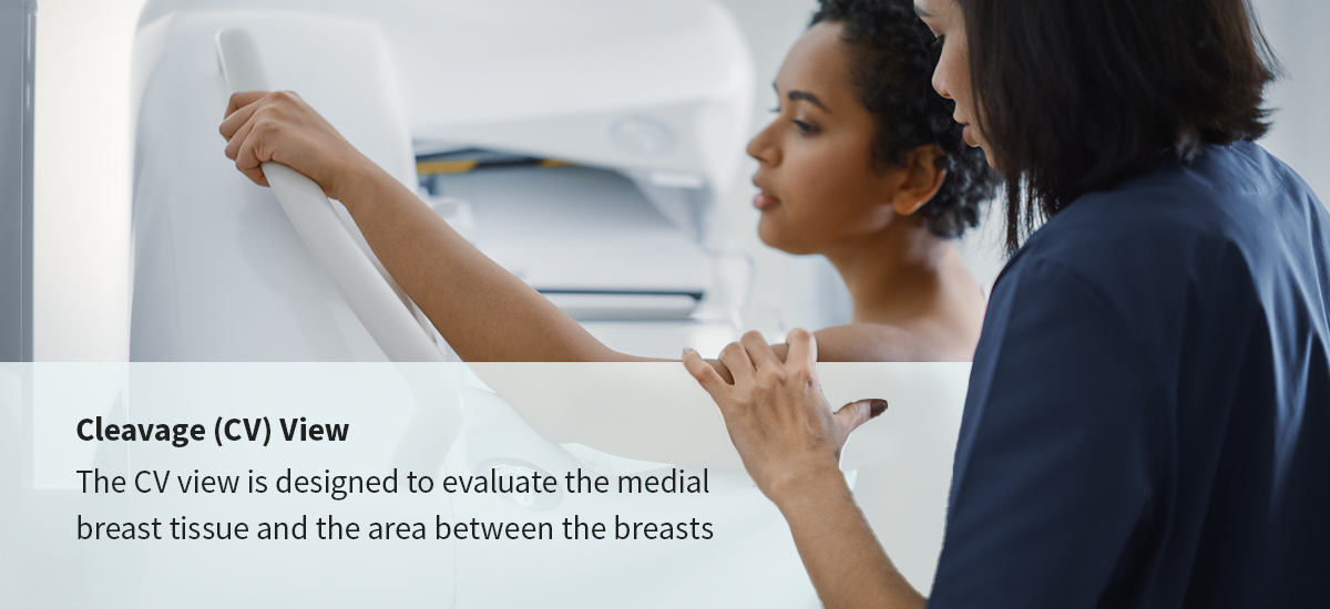Cleavage (CV) View  The CV view is designed to evaluate the medial breast tissue and the area between the breasts
